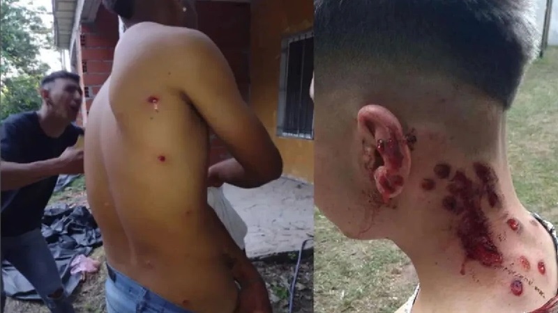 heridas de armas de aire comprimido para defensa